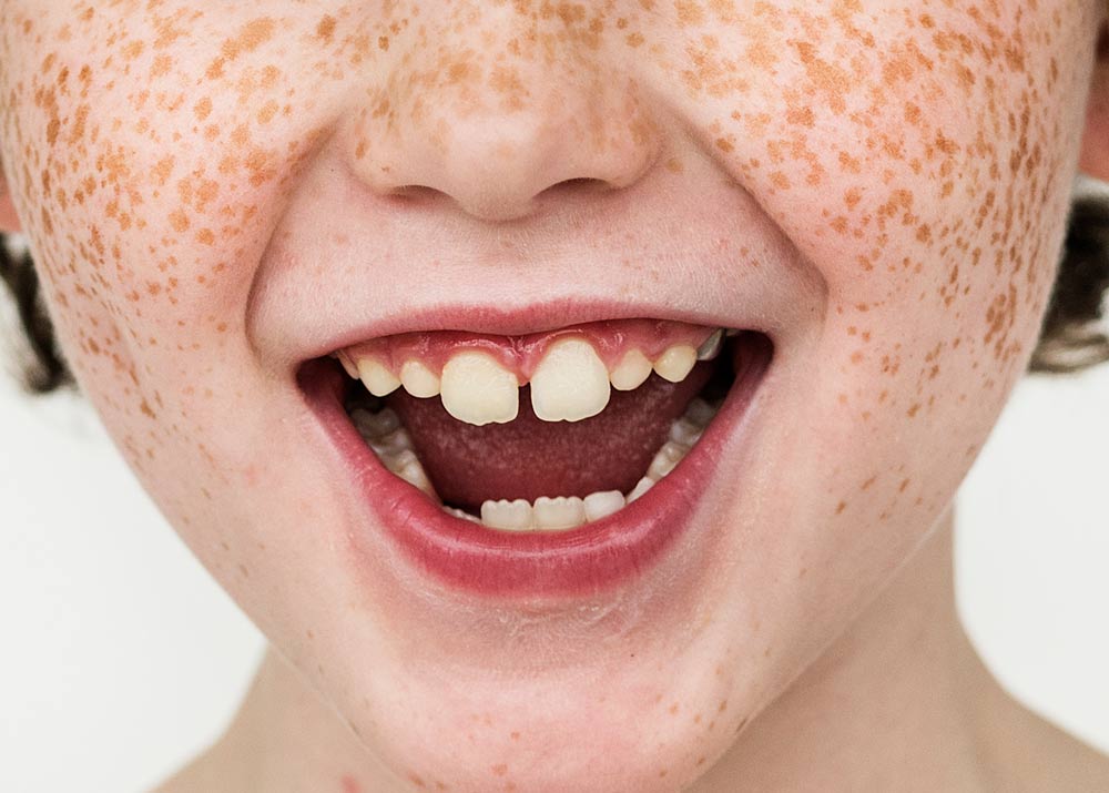 Especialidades dentales Gutiérrez Orio Salud Dental